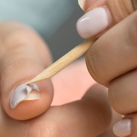 Peeling Nails: Causes and Treatments, According to Experts
